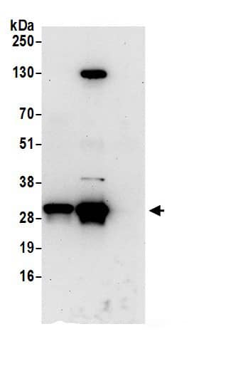 Immunoprecipitation:IMPA1 AntibodyNBP3-28947] -Detection of human IMPA1 by western blot of immunoprecipitates. Samples: Whole cell lysate (0.5 or 1.0 mg per IP reaction; 20% of IP loaded) from Jurkat cells prepared using NETN lysis buffer. Antibodies: Affinity purified rabbit anti-IMPA1 antibody NBP3-28947 (lot NBP3-28947-1) used for IP at 6 µg per reaction. IMPA1 was also immunoprecipitated by rabbit anti-IMPA1 antibody. For blotting immunoprecipitated IMPA1, NBP3-28947 was used at 1 µg/ml. Detection: Chemiluminescence with an exposure time of 30 seconds.