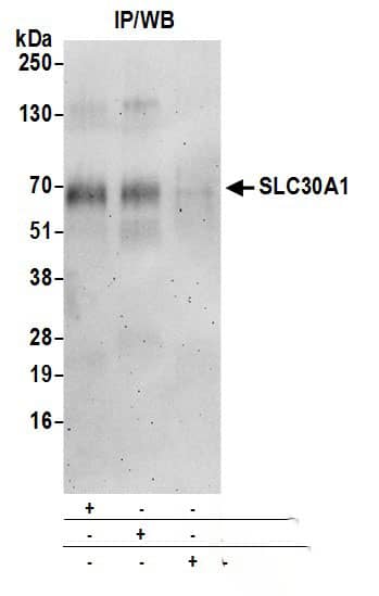 Immunoprecipitation:[NBP3-28950]-Detection of human SLC30A1 by western blot of immunoprecipitates. Samples: Whole cell lysate from HeLa cells prepared using NETN lysis buffer. Antibodies: Affinity purified rabbit anti-SLC30A1 antibody used for IP at 6 µg per reaction. SLC30A1 was also immunoprecipitated by rabbit anti-SLC30A1 antibody. For blotting immunoprecipitated SLC30A1, was used at 0. 4 µg/ml. Detection: Chemiluminescence with an exposure time of 30 seconds.
