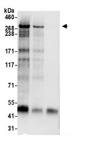 Immunoprecipitation:ZNF292 AntibodyNBP3-28951] -Detection of human ZNF292 by western blot of immunoprecipitates. Samples: Whole cell lysate (1 mg for IP, 20% of IP loaded) from Jurkat cells. Antibodies: Affinity purified rabbit anti-ZNF292 antibody NBP3-28951 used for IP at 6 µg/mg lysate. ZNF292 was also immunoprecipitated by rabbit anti-ZNF292 antibody, which recognizes a downstream epitope. For blotting immunoprecipitated ZNF292, NBP3-28951 was used at 1 µg/ml. Detection: Chemiluminescence with an exposure time of 30 seconds.