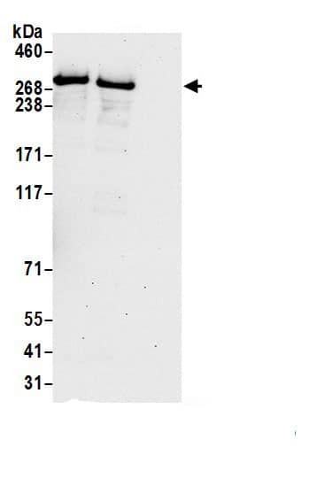 Immunoprecipitation:DMXL2 AntibodyNBP3-28952] -Detection of human DMXL2 by western blot of immunoprecipitates. Samples: Whole cell lysate (1.0 mg per IP reaction; 20% of IP loaded) from Jurkat cells prepared using NETN lysis buffer. Antibodies: Affinity purified rabbit anti-DMXL2 antibody (NBP3-28952 lot 1) used for IP at 6 µg per reaction. DMXL2 was also immunoprecipitated by rabbit anti-DMXL2 antibody . For blotting immunoprecipitated DMXL2, NBP3-28952 was used at 0.4 mg/ml. Detection: Chemiluminescence with an exposure time of 30 seconds.