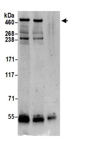 Immunoprecipitation VPS13D Antibody