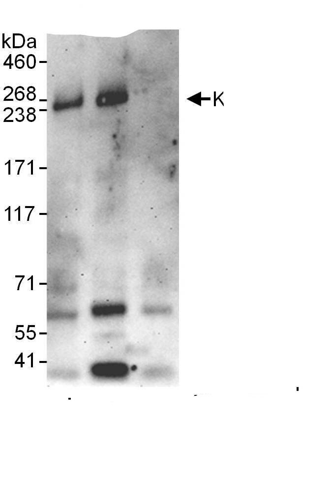 Immunoprecipitation:MTCL1 AntibodyNBP3-28955] -Detection of human KIAA0802 by western blot of immunoprecipitates. Samples: Whole cell lysate (1 mg for IP, 20% of IP loaded) from HeLa cells. Antibodies: Affinity purified rabbit anti-KIAA0802 antibody NBP3-28955 used for IP at 10 µg/mg lysate. KIAA0802 was also immunoprecipitated by rabbit anti-KIAA0802 antibody, which recognizes a downstream epitope. For blotting immunoprecipitated KIAA0802, A302-787A was used at 1 µg/ml. Detection: Chemiluminescence with an exposure time of 3 minutes.