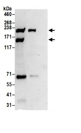 Immunoprecipitation:RhoGAP AntibodyNBP3-28957] -Detection of human ARHGAP5 by western blot of immunoprecipitates. Samples: Whole cell lysate (0.5 or 1.0 mg per IP reaction; 20% of IP loaded) from 293T cells prepared using NETN lysis buffer. Antibodies: Affinity purified rabbit anti-ARHGAP5 antibody NBP3-28957 (lot NBP3-28957-1) used for IP at 6 µg per reaction. ARHGAP5 was also immunoprecipitated by rabbit anti-ARHGAP5 antibody. For blotting immunoprecipitated ARHGAP5, NBP3-28957 was used at 1 µg/ml. Detection: Chemiluminescence with an exposure time of 3 minutes.