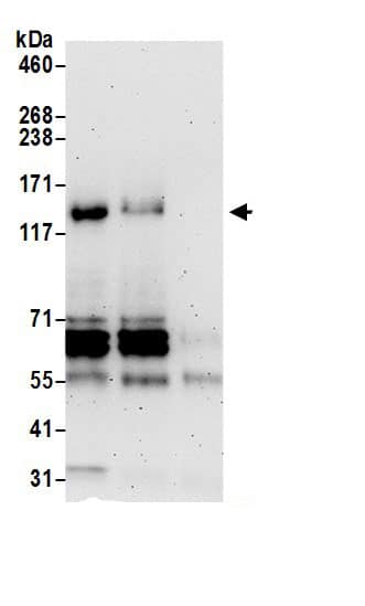 Immunoprecipitation:FHOD1 AntibodyNBP3-28958] -Detection of human FHOD1 by western blot of immunoprecipitates. Samples: Whole cell lysate (0.5 or 1.0 mg per IP reaction; 20% of IP loaded) from 293T cells prepared using NETN lysis buffer. Antibodies: Affinity purified rabbit anti-FHOD1 antibody NBP3-28958 (lot NBP3-28958-1) used for IP at 6 µg per reaction. FHOD1 was also immunoprecipitated by rabbit anti-FHOD1 antibody. For blotting immunoprecipitated FHOD1, NBP3-28958 was used at 1 µg/ml. Detection: Chemiluminescence with an exposure time of 3 minutes.