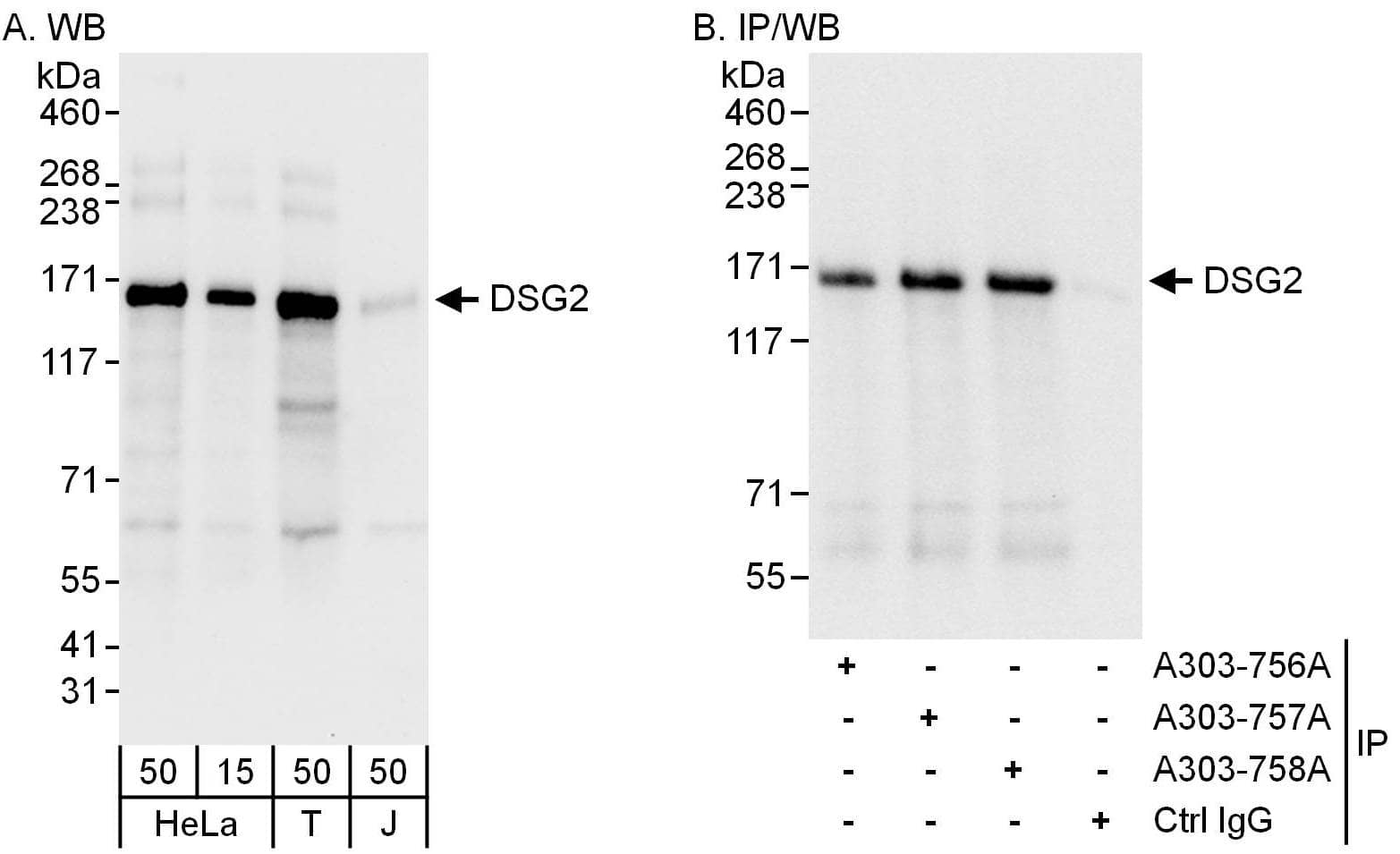 Western Blot:[NBP3-28959]-Detection of human DSG2 by western blot and immunoprecipitation. Samples: Whole cell lysate from HeLa , HEK293T and Jurkat cells. Antibodies: Affinity purified rabbit anti-DSG2 antibody used for WB at 0. 1 µg/ml and 1 µg/ml and used for IP at 6 µg/mg lysate. DSG2 was also immunoprecipitated by rabbit anti-DSG2 antibodies and , which recognize upstream epitopes. Detection: Chemiluminescence with exposure times of 3 seconds and 1 seconds.