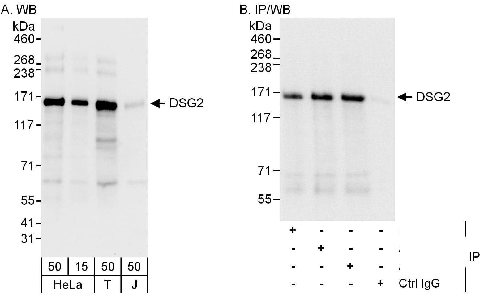 Western Blot:[NBP3-28959]-Desmoglein-2 Antibody