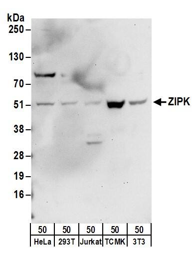 Western Blot:[NBP3-28962]-Detection of human and mouse ZIPK by western blot. Samples: Whole cell lysate from HeLa, HEK293T, Jurkat, mouse TCMK-1, and mouse NIH 3T3 cells. Antibodies: Affinity purified rabbit anti-ZIPK antibody used for WB at 0. 4 µg/ml. Detection: Chemiluminescence with an exposure time of 30 seconds.