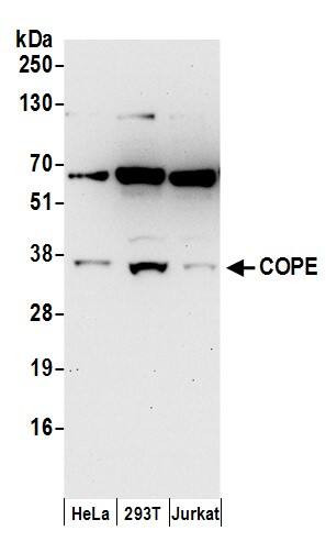 Western Blot:[NBP3-28963]-Detection of human COPE by western blot. Samples: Whole cell lysate from HeLa, HEK293T, and Jurkat cells prepared using NETN lysis buffer. Antibodies: Affinity purified rabbit anti-COPE antibody used for WB at 1 µg/ml. Detection: Chemiluminescence with an exposure time of 30 seconds.