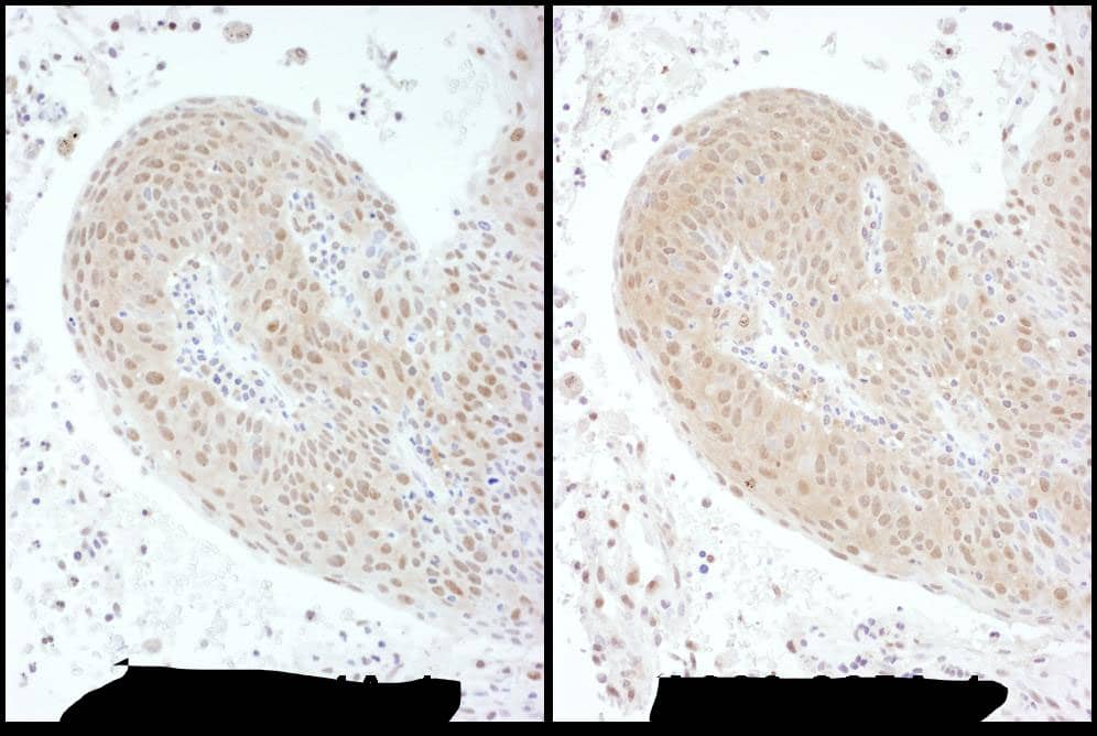 Immunohistochemistry:[NBP3-28965]-PSMC6 Antibody