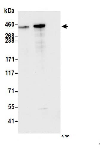 Immunoprecipitation:BRCA2 AntibodyNBP3-28966] -Detection of human BRCA2 by western blot of immunoprecipitates. Samples: Whole cell lysate (1.0 mg per IP reaction; 20% of IP loaded) from HEK293T cells prepared using NETN lysis buffer. Antibodies: Affinity purified rabbit anti-BRCA2 antibody NBP3-28966 (lot NBP3-28966-3) used for IP at 6 µg per reaction. BRCA2 was also immunoprecipitated by a previous lot of this antibody (lot NBP3-28966-2). For blotting immunoprecipitated BRCA2, NBP3-28966 was used at 0.04 µg/ml. Detection: Chemiluminescence with an exposure time of 3 seconds.