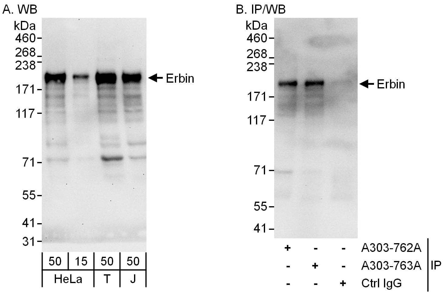 Western Blot:[NBP3-28968]-Detection of human Erbin by western blot and immunoprecipitation. Samples: Whole cell lysate from HeLa , HEK293T and Jurkat cells. Antibodies: Affinity purified rabbit anti-Erbin antibody used for WB at 0. 1 µg/ml and 1 µg/ml and used for IP at 6 µg/mg lysate. Erbin was also immunoprecipitated by rabbit anti-Erbin antibody , which recognizes a downstream epitope. Detection: Chemiluminescence with exposure times of 30 seconds and 10 seconds.
