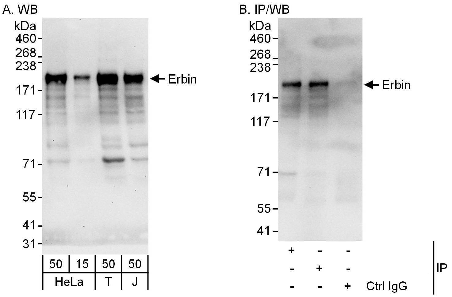 Western Blot:[NBP3-28968]-Erbin Antibody