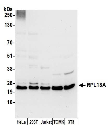 Western Blot:[NBP3-28973]-Detection of human and mouse RPL18A by western blot. Samples: Whole cell lysate from HeLa, HEK293T, Jurkat, mouse TCMK-1, and mouse NIH 3T3 cells prepared using NETN lysis buffer. Antibody: Affinity purified rabbit antibody used for WB at 0. 1 µg/ml. Detection: Chemiluminescence with an exposure time of 30 seconds.