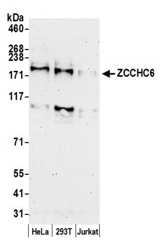 Western Blot ZCCHC6 Antibody