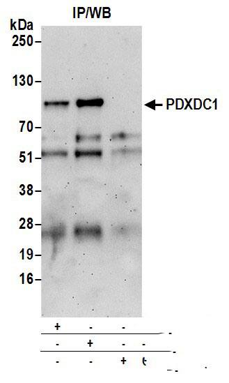 Immunoprecipitation:[NBP3-28976]-Detection of human PDXDC1 by western blot of immunoprecipitates. Samples: Whole cell lysate from 293T cells prepared using NETN lysis buffer. Antibodies: Affinity purified rabbit anti-PDXDC1 antibody used for IP at 6 µg per reaction. PDXDC1 was also immunoprecipitated by rabbit anti-PDXDC1 antibody. For blotting immunoprecipitated PDXDC1, was used at 1 µg/ml. Detection: Chemiluminescence with an exposure time of 3 minutes.