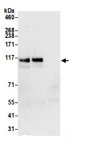 Immunoprecipitation:HIP1 AntibodyNBP3-28977] -Detection of human HIP1 by western blot of immunoprecipitates. Samples: Whole cell lysate (0.5 or 1.0 mg per IP reaction; 20% of IP loaded) from HeLa cells prepared using NETN lysis buffer. Antibodies: Affinity purified rabbit anti-HIP1 antibody NBP3-28977 (lot NBP3-28977-1) used for IP at 6 µg per reaction. HIP1 was also immunoprecipitated by rabbit anti-HIP1 antibody. For blotting immunoprecipitated HIP1, NBP3-28977 was used at 1 µg/ml. Detection: Chemiluminescence with an exposure time of 30 seconds.