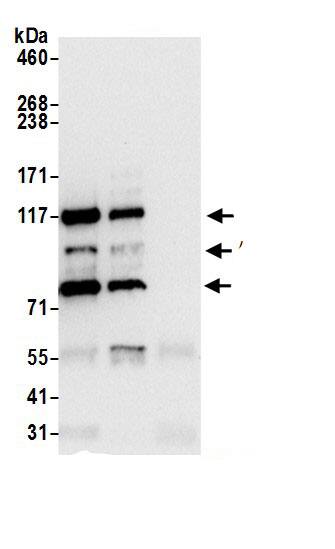 Immunoprecipitation:AP3B1 AntibodyNBP3-28978] -Detection of human AP3B1 by western blot of immunoprecipitates. Samples: Whole cell lysate (0.5 or 1.0 mg per IP reaction; 20% of IP loaded) from 293T cells prepared using NETN lysis buffer. Antibodies: Affinity purified rabbit anti-AP3B1 antibody NBP3-28978 (lot NBP3-28978-1) used for IP at 6 µg per reaction. AP3B1 was also immunoprecipitated by rabbit anti-AP3B1 antibody. For blotting immunoprecipitated AP3B1, NBP3-28978 was used at 0.4 µg/ml. Detection: Chemiluminescence with an exposure time of 10 seconds.