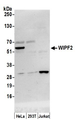 Western Blot:[NBP3-28979]-WIRE Antibody