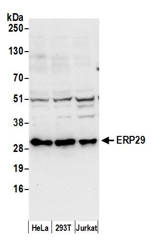 Western Blot:[NBP3-28980]-Detection of human ERP29 by western blot. Samples: Whole cell lysate from HeLa, HEK293T, and Jurkat cells prepared using NETN lysis buffer. Antibody: Affinity purified rabbit anti-ERP29 antibody used for WB at 0. 1 µg/ml. Detection: Chemiluminescence with an exposure time of 10 seconds.