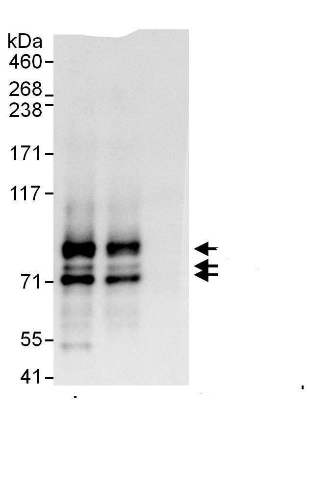 Immunoprecipitation:Splicing Factor 1 AntibodyNBP3-28982] -Detection of human SF1 by western blot of immunoprecipitates. Samples: Whole cell lysate (1 mg for IP, 20% of IP loaded) from HeLa cells. Antibodies: Affinity purified rabbit anti-SF1 antibody NBP3-28982 used for IP at 6 µg/mg lysate. SF1 was also immunoprecipitated by rabbit anti-SF1 antibody, which recognizes an upstream epitope. For blotting immunoprecipitated SF1,  was used at 0.4 µg/ml. Detection: Chemiluminescence with an exposure time of 1 second.