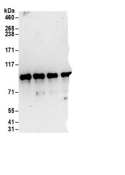 Immunoprecipitation:Ccd1/DIXDC1 AntibodyNBP3-28983] -Detection of human DIXDC1 by western blot of immunoprecipitates. Samples: Whole cell lysate (1 mg for IP; 20% of IP loaded) from 293T cells. Antibodies: Affinity purified rabbit anti-DIXDC1 antibody NBP3-28983 (lot NBP3-28983-1) used for IP at 6 µg/mg lysate. DIXDC1 was also immunoprecipitated by rabbit anti-DIXDC1 antibodies,  and . For blotting immunoprecipitated DIXDC1,  was used at 1 µg/ml. Detection: Chemiluminescence with an exposure time of 3 minutes.