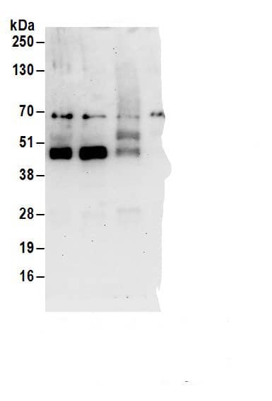 Immunoprecipitation:PRR5 AntibodyNBP3-28984] -Detection of human Protor-1 by western blot of immunoprecipitates. Samples: Whole cell lysate (1 mg for IP; 20% of IP loaded) from 293T cells. Antibodies: Affinity purified rabbit anti-Protor-1 antibody NBP3-28984 (lot NBP3-28984-1) used for IP at 6 µg/mg lysate. Protor-1 was also immunoprecipitated by rabbit anti-Protor-1 antibodies . For blotting immunoprecipitated Protor-1,  was used at 1 µg/ml. Detection: Chemiluminescence with an exposure time of 30 seconds.