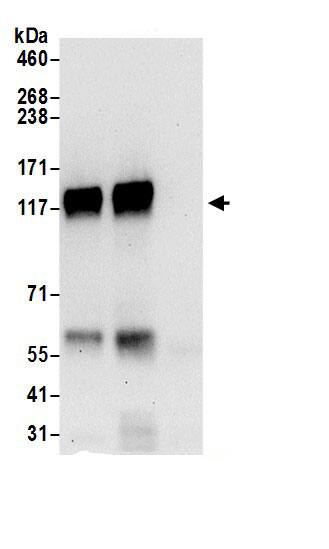 Immunoprecipitation:PLCL2 AntibodyNBP3-28985] -Detection of human PLCL2 by western blot of immunoprecipitates. Samples: Whole cell lysate (0.5 or 1.0 mg per IP reaction; 20% of IP loaded) from 293T cells prepared using NETN lysis buffer. Antibodies: Affinity purified rabbit anti-PLCL2 antibody NBP3-28985 (lot NBP3-28985-1) used for IP at 6 µg per reaction. PLCL2 was also immunoprecipitated by rabbit anti-PLCL2 antibody. For blotting immunoprecipitated PLCL2, NBP3-28985 was used at 1 µg/ml. Detection: Chemiluminescence with an exposure time of 30 seconds.
