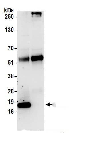 Immunoprecipitation AP1S1 Antibody