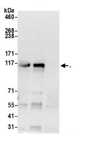 Immunoprecipitation:MSH3 AntibodyNBP3-28987] -Detection of human MSH3 by western blot of immunoprecipitates. Samples: Whole cell lysate (0.5 or 1.0 mg per IP reaction; 20% of IP loaded) from HeLa cells prepared using NETN lysis buffer. Antibodies: Affinity purified rabbit anti-MSH3 antibody NBP3-28987 (lot NBP3-28987-1) used for IP at 6 µg per reaction. MSH3 was also immunoprecipitated by rabbit anti-MSH3 antibody. For blotting immunoprecipitated MSH3, NBP3-28987 was used at 1 µg/ml. Detection: Chemiluminescence with an exposure time of 30 seconds.