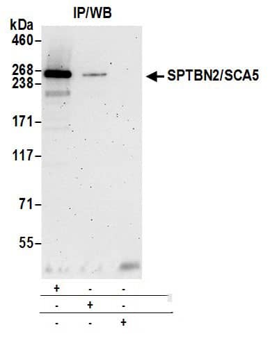 Immunoprecipitation:[NBP3-28988]-Detection of human SPTBN2/SCA5 by western blot of immunoprecipitates. Samples: Whole cell lysate from HeLa cells prepared using NETN lysis buffer. Antibodies: Affinity purified rabbit anti-SPTBN2/SCA5 antibody used for IP at 6 µg per reaction. SPTBN2/SCA5 was also immunoprecipitated by rabbit anti-SPTBN2/SCA5 antibody. For blotting immunoprecipitated SPTBN2/SCA5, was used at 0. 4 µg/ml. Detection: Chemiluminescence with an exposure time of 3 minutes.