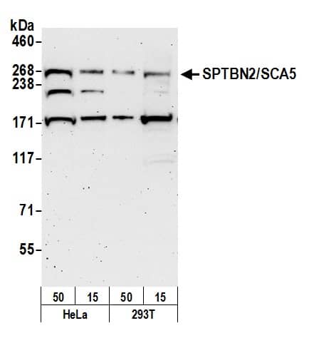 Western Blot:[NBP3-28988]-Spectrin beta 3 Antibody