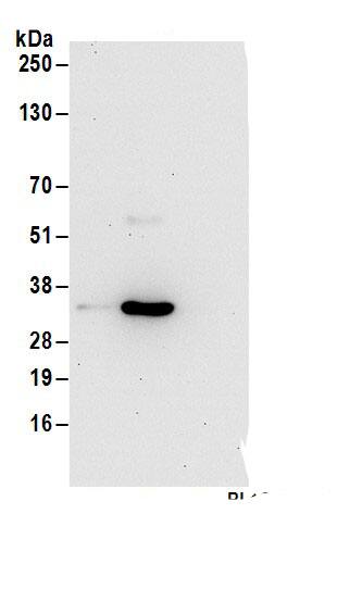 Immunoprecipitation:Purine Nucleoside Phosphorylase/PNP AntibodyNBP3-28989] -Detection of human PNP by western blot of immunoprecipitates. Samples: Whole cell lysate (1 mg for IP; 20% of IP loaded) from 293T cells. Antibodies: Affinity purified rabbit anti-PNP antibody NBP3-28989 (lot NBP3-28989-1) used for IP at 6 µg/mg lysate. PNP was inefficiently immunoprecipitated by rabbit anti-PNP antibody. For blotting immunoprecipitated PNP, NBP3-28989 was used at 1 µg/ml. Detection: Chemiluminescence with an exposure time of 30 seconds.