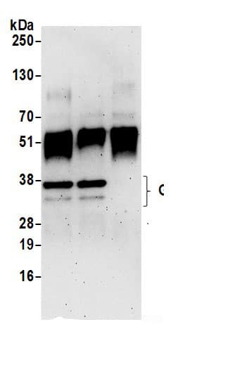 Immunoprecipitation:TFIIE beta AntibodyNBP3-28990] -Detection of human GTF2E2 by western blot of immunoprecipitates. Samples: Whole cell lysate (0.5 or 1.0 mg per IP reaction; 20% of IP loaded) from 293T cells prepared using NETN lysis buffer. Antibodies: Affinity purified rabbit anti-GTF2E2 antibody NBP3-28990 (lot NBP3-28990-1) used for IP at 6 µg per reaction. GTF2E2 was also immunoprecipitated by rabbit anti-GTF2E2 antibody. For blotting immunoprecipitated GTF2E2, NBP3-28990 was used at 0.4 µg/ml. Detection: Chemiluminescence with an exposure time of 3 minutes.