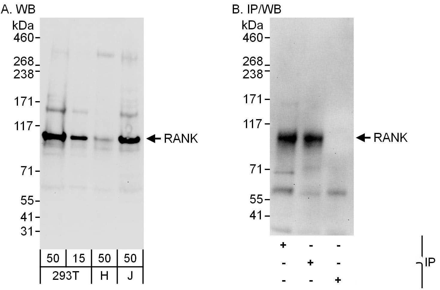 Western Blot:[NBP3-28991]-Detection of human RANK by western blot and immunoprecipitation. Samples: Whole cell lysate from HEK293T , HeLa and Jurkat cells. Antibodies: Affinity purified rabbit anti-RANK antibody used for WB at 0. 4 µg/ml and 1 µg/ml and used for IP at 6 µg/mg lysate. RANK was also immunoprecipitated by rabbit anti-RANK antibody , which recognizes a downstream epitope. Detection: Chemiluminescence with exposure times of 10 seconds and 30 seconds.