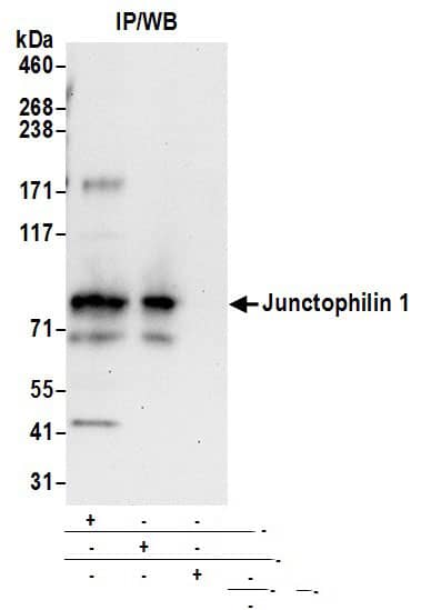 Immunoprecipitation:[NBP3-28993]-Detection of human Junctophilin 1 by western blot of immunoprecipitates. Samples: Whole cell lysate from 293T cells prepared using RIPA lysis buffer. Antibodies: Affinity purified rabbit anti-Junctophilin 1 antibody used for IP at 6 µg per reaction. Junctophilin 1 was also immunoprecipitated by rabbit anti-Junctophilin 1 antibody. For blotting immunoprecipitated Junctophilin 1, was used at 1 µg/ml. Detection: Chemiluminescence with an exposure time of 30 seconds.