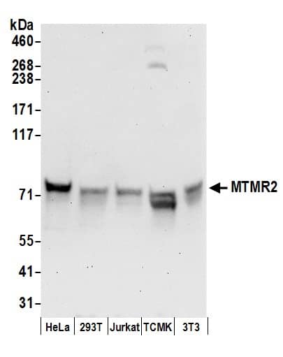 Western Blot:[NBP3-28994]-Detection of human and mouse MTMR2 by western blot. Samples: Whole cell lysate from HeLa, HEK293T, Jurkat, mouse TCMK-1, and mouse NIH 3T3 cells prepared using NETN lysis buffer. Antibodies: Affinity purified rabbit anti-MTMR2 antibody used for WB at 0. 4 µg/ml. Detection: Chemiluminescence with an exposure time of 30 seconds.