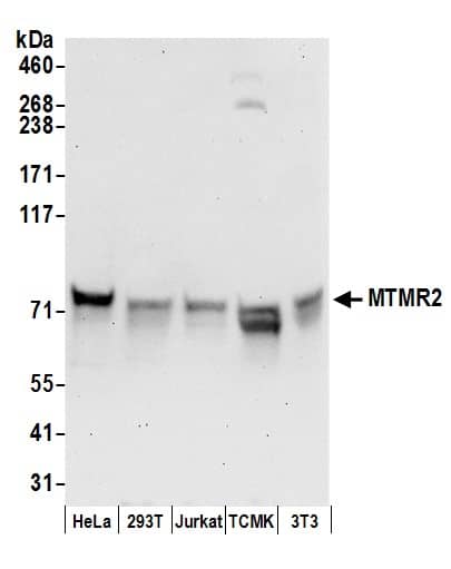 Western Blot:[NBP3-28994]-MTMR2 Antibody