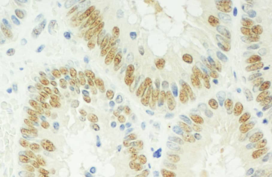 Immunohistochemistry:[NBP3-28999]-RBM17 Antibody