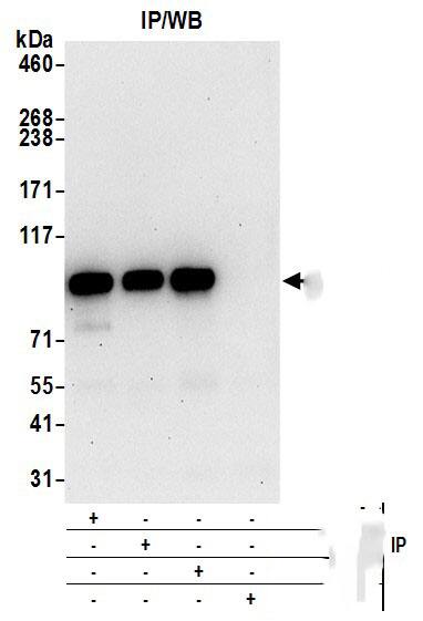 Immunoprecipitation:[NBP3-29001]-Detection of human DDX21 by western blot of immunoprecipitates. Samples: Whole cell lysate from HeLa cells prepared using NETN lysis buffer. Antibodies: Affinity purified rabbit anti-DDX21 antibody used for IP at 6 µg per reaction. DDX21 was also immunoprecipitated by rabbit anti-DDX21 antibodies and. For blotting immunoprecipitated DDX21, was used at 1 µg/ml. Detection: Chemiluminescence with an exposure time of 30 seconds.