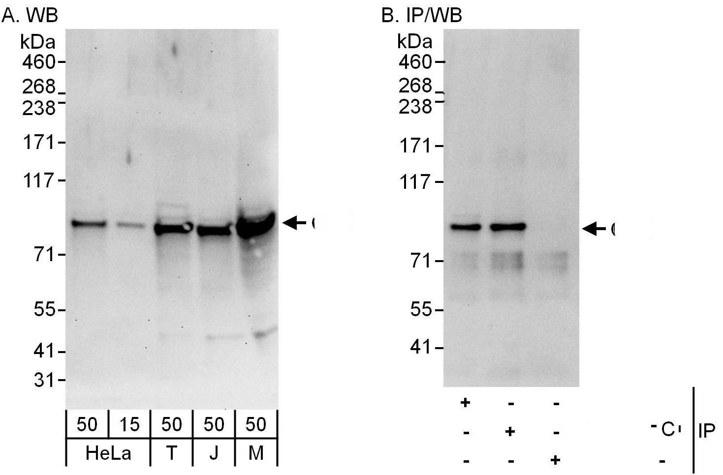 Western Blot:[NBP3-29002]-Detection of human and mouse Cul1 by western blot and immunoprecipitation. Samples: Whole cell lysate from HeLa , HEK293T , Jurkat and mouse NIH 3T3 cells. Antibodies: Affinity purified rabbit anti-Cul1 antibody used for WB at 0. 04 µg/ml and 0. 4 µg/ml and used for IP at 6 µg/mg lysate. Cul1 was also immunoprecipitated by rabbit anti-Cul1 antibody , which recognizes an upstream epitope. Detection: Chemiluminescence with exposure times of 30 seconds and 10 seconds.