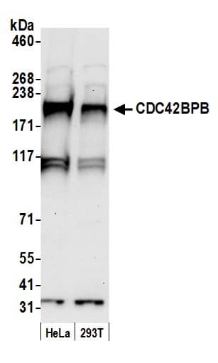 Western Blot:[NBP3-29003]-Detection of human CDC42BPB by western blot. Samples: Whole cell lysate from HeLa and 293T cells prepared using NETN lysis buffer. Antibody: Affinity purified rabbit anti-CDC42BPB antibody used for WB at 0. 1 µg/ml. Detection: Chemiluminescence with an exposure time of 30 seconds.