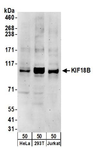 Western Blot:[NBP3-29006]-Detection of human KIF18B by western blot. Samples: Whole cell lysate from HeLa, HEK293T, and Jurkat cells. Antibodies: Affinity purified rabbit anti-KIF18B antibody used for WB at 0. 1 µg/ml. Detection: Chemiluminescence with an exposure time of 3 minutes.