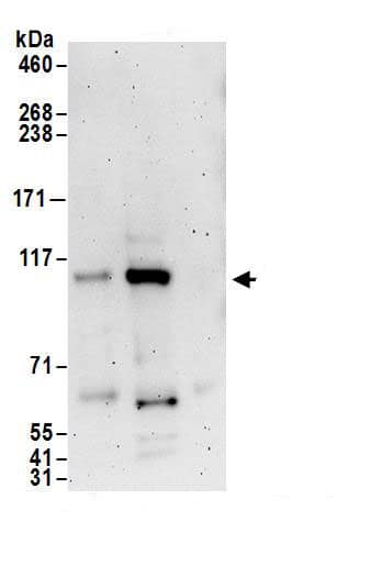 Immunoprecipitation:Exportin-T AntibodyNBP3-29009] -Detection of human Exportin-T by western blot of immunoprecipitates. Samples: Whole cell lysate (1 mg for IP; 20% of IP loaded) from HEK293T cells. Antibodies: Affinity purified rabbit anti-Exportin-T antibody NBP3-29009 (lot NBP3-29009-1) used for IP at 6 µg/mg lysate. Exportin-T was also immunoprecipitated by rabbit anti-Exportin-T antibody. For blotting immunoprecipitated Exportin-T, NBP3-29009 was used at 1 µg/ml. Detection: Chemiluminescence with an exposure time of 3 minutes.