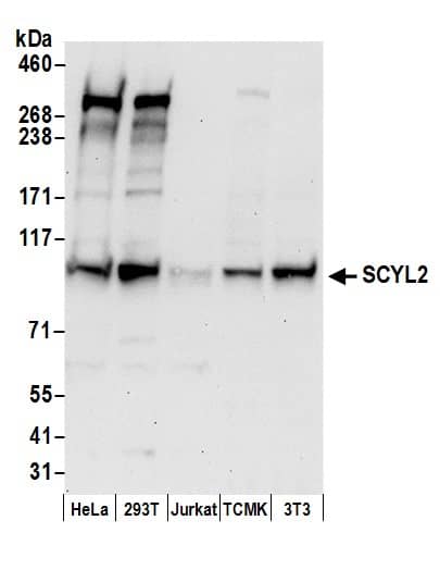 Western Blot:[NBP3-29010]-Detection of human and mouse SCYL2 by western blot. Samples: Whole cell lysate from HeLa, HEK293T, Jurkat, mouse TCMK-1, and mouse NIH 3T3 cells prepared using NETN lysis buffer. Antibody: Affinity purified rabbit anti-SCYL2 antibody used for WB at 0. 04 µg/ml. Detection: Chemiluminescence with an exposure time of 30 seconds.