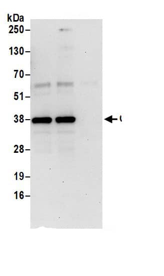 Immunoprecipitation:HCA59 AntibodyNBP3-29011] -Detection of human C9orf78 by western blot of immunoprecipitates. Samples: Whole cell lysate (0.5 or 1.0 mg per IP reaction; 20% of IP loaded) from 293T cells prepared using NETN lysis buffer. Antibodies: Affinity purified rabbit anti-C9orf78 antibody NBP3-29011 (lot NBP3-29011-1) used for IP at 6 µg per reaction. C9orf78 was also immunoprecipitated by rabbit anti-C9orf78 antibody BL17619. For blotting immunoprecipitated C9orf78, NBP3-29011 was used at 0.4 µg/ml. Detection: Chemiluminescence with an exposure time of 30 seconds.