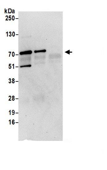 Immunoprecipitation:MSANTD2 AntibodyNBP3-29012] -Detection of human MSANTD2 by western blot of immunoprecipitates. Samples: Whole cell lysate (0.5 or 1.0 mg per IP reaction; 20% of IP loaded) from 293T cells prepared using NETN lysis buffer. Antibodies: Affinity purified rabbit anti-MSANTD2 antibody NBP3-29012 (lot NBP3-29012-1) used for IP at 6 µg per reaction. MSANTD2 was also immunoprecipitated by rabbit anti-MSANTD2 antibody. For blotting immunoprecipitated MSANTD2, blotting antibody was used at 0.4 µg/ml. Detection: Chemiluminescence with an exposure time of 30 seconds.