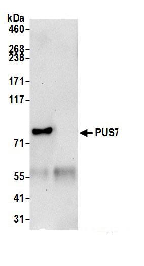 Immunoprecipitation:PUS7 AntibodyNBP3-29013] -Detection of human PUS7 by western blot of immunoprecipitates. Samples: Whole cell lysate (0.5 or 1.0 mg per IP reaction; 20% of IP loaded) from 293T cells prepared using NETN lysis buffer. Antibodies: Affinity purified rabbit anti-PUS7 antibody NBP3-29013 (lot NBP3-29013-1) used for IP at 6 µg per reaction. For blotting immunoprecipitated PUS7, NBP3-29013 was used at 1 µg/ml. Detection: Chemiluminescence with an exposure time of 30 seconds.