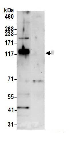 Immunoprecipitation:FNDC3A AntibodyNBP3-29014] -Detection of human FNDC3A by western blot of immunoprecipitates. Samples: Whole cell lysate (0.5 or 1.0 mg per IP reaction; 20% of IP loaded) from 293T cells prepared using NETN lysis buffer. Antibodies: Affinity purified rabbit anti-FNDC3A antibody NBP3-29014 (lot NBP3-29014-1) used for IP at 6 µg per reaction. For blotting immunoprecipitated FNDC3A, NBP3-29014 was used at 1 µg/ml. Detection: Chemiluminescence with an exposure time of 30 seconds.