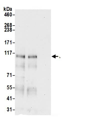 Immunoprecipitation:Lipin 1 AntibodyNBP3-29015] -Detection of human LPIN1 by western blot of immunoprecipitates. Samples: Whole cell lysate (0.5 or 1.0 mg per IP reaction; 20% of IP loaded) from Jurkat cells prepared using NETN lysis buffer. Antibodies: Affinity purified rabbit anti-LPIN1 antibody NBP3-29015 (lot NBP3-29015-1) used for IP at 6 µg per reaction. LPIN1 was also immunoprecipitated by rabbit anti-LPIN1 antibody. For blotting immunoprecipitated LPIN1, NBP3-29015 was used at 1 µg/ml. Detection: Chemiluminescence with an exposure time of 30 seconds.