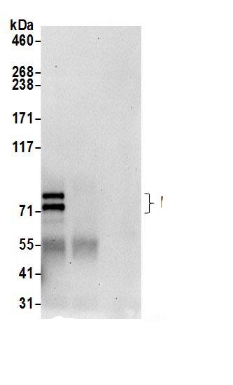 Immunoprecipitation:PALS1/MPP5 AntibodyNBP3-29016] -Detection of human MPP5 by western blot of immunoprecipitates. Samples: Whole cell lysate (0.5 or 1.0 mg per IP reaction; 20% of IP loaded) from 293T cells prepared using NETN lysis buffer. Antibodies: Affinity purified rabbit anti-MPP5 antibody NBP3-29016 (lot NBP3-29016-1) used for IP at 6 µg per reaction. MPP5 was also immunoprecipitated by rabbit anti-MPP5 antibody. For blotting immunoprecipitated MPP5, NBP3-29016 was used at 0.4 µg/ml. Detection: Chemiluminescence with an exposure time of 30 seconds.